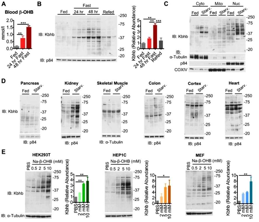 Advancements in Protein lipidation Research